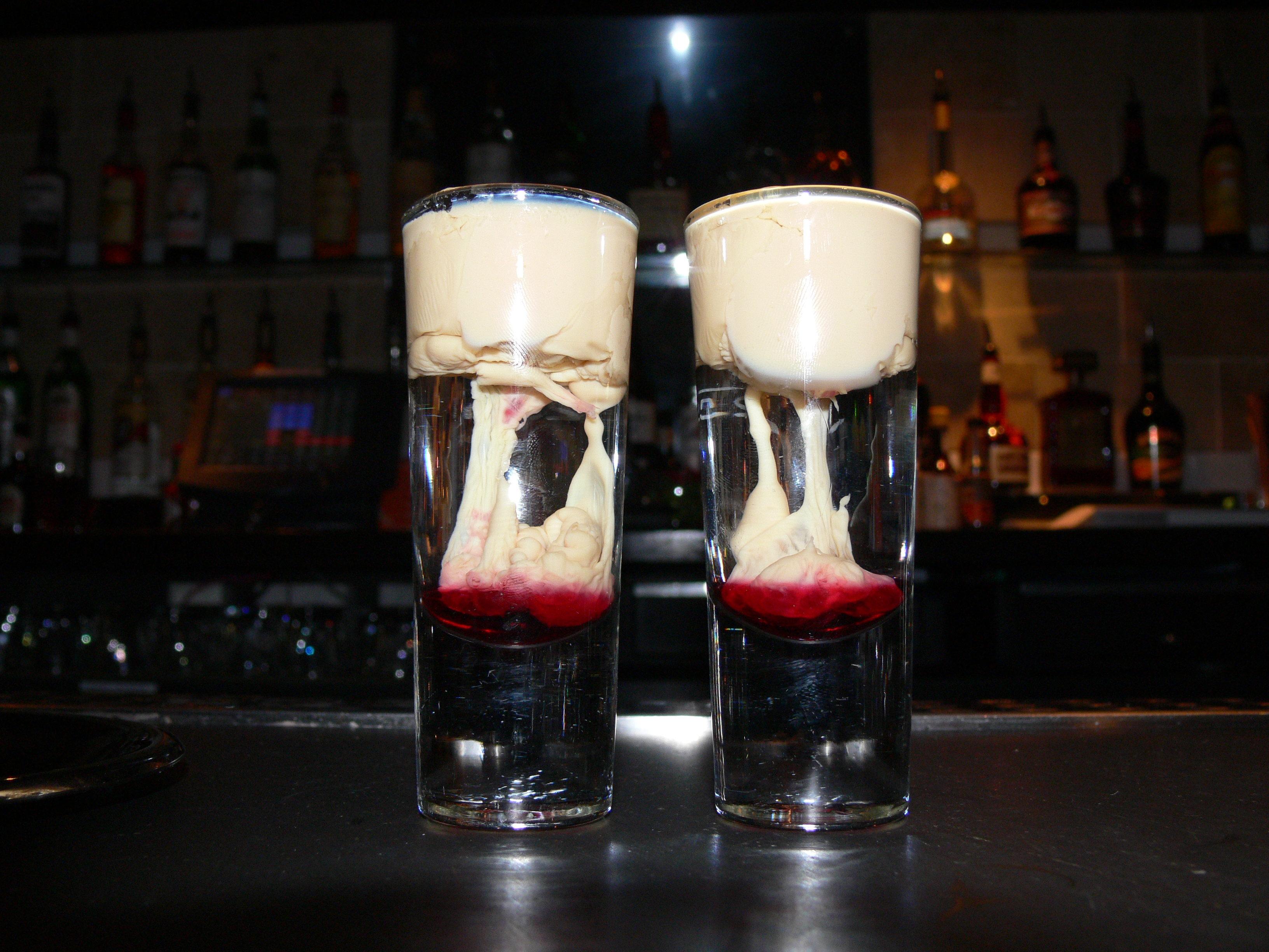 P1020647_%28brain_haemorrhage%29.jpg