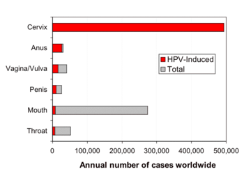 350px-Cases_of_HPV_cancers_graph.png