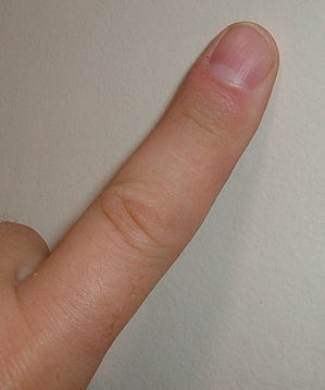 299px-Finger.agr.jpg